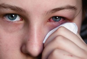 Các triệu chứng và cách điều trị bệnh đau mắt đỏ