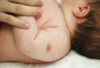 Vắc xin lao (BCG) được tiêm cho trẻ sơ sinh vào lúc nào?