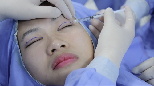 Phẫu thuật cắt mắt to được thực hiện đúng chuẩn theo công nghệ Hàn